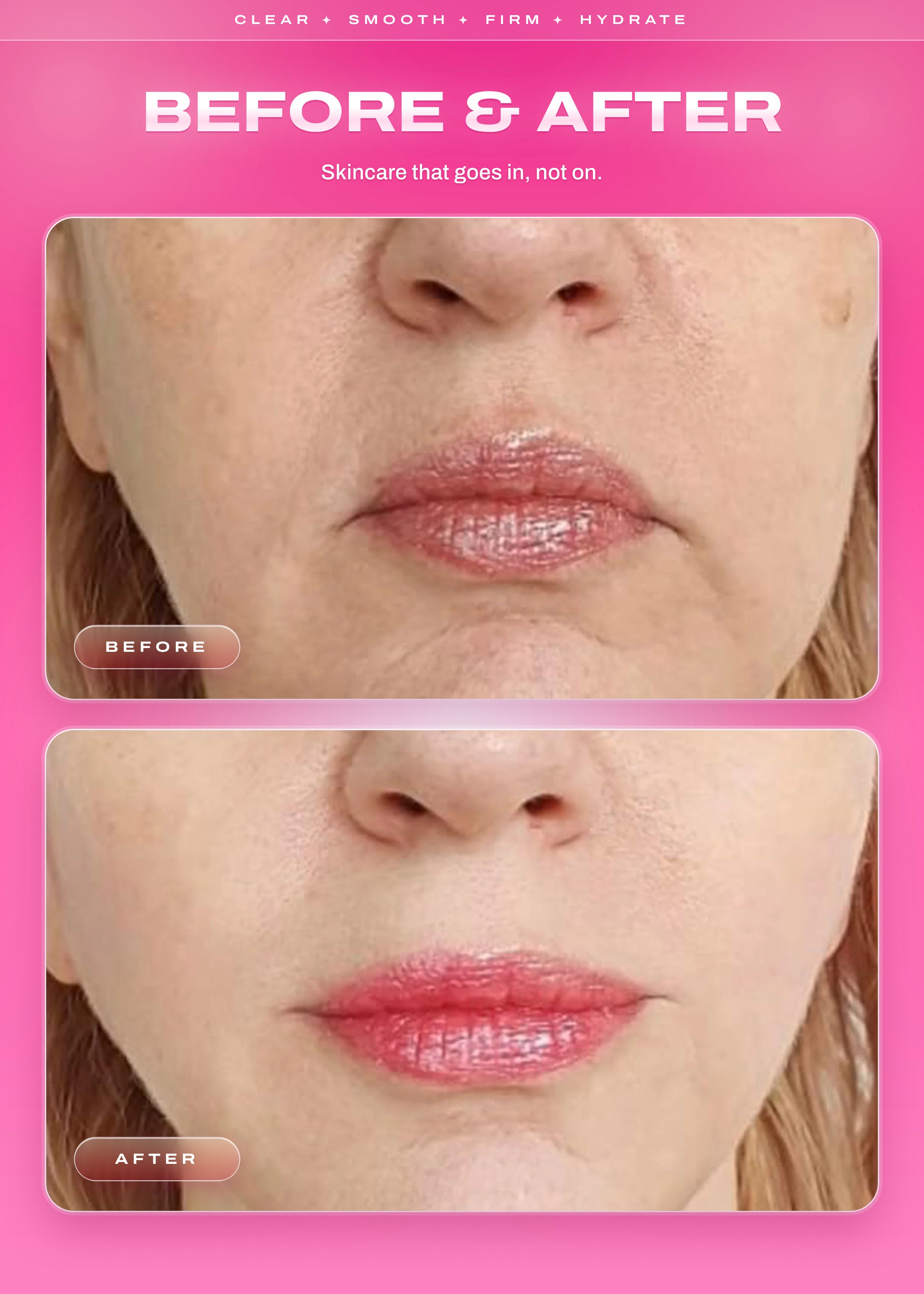 It Girl Skin | Strawberry Beauty Gummies